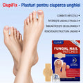 CiupiFix - Plasturi Anti Ciuperca