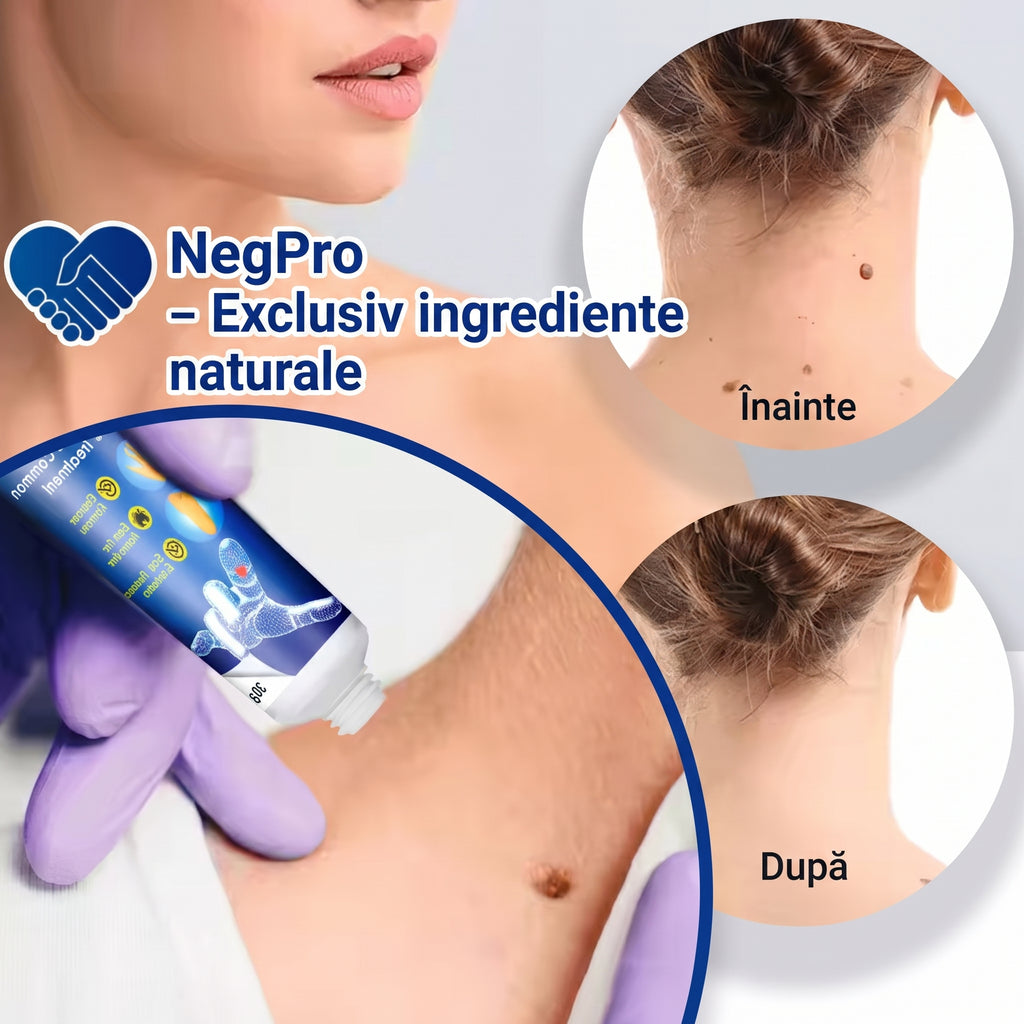 NegPro - Crema Anti Negi