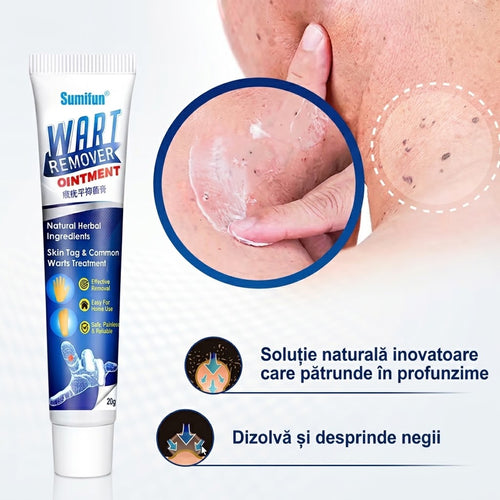 NegPro - Crema Anti Negi