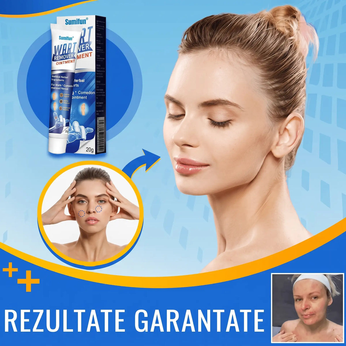 NegPro - Crema Anti Negi