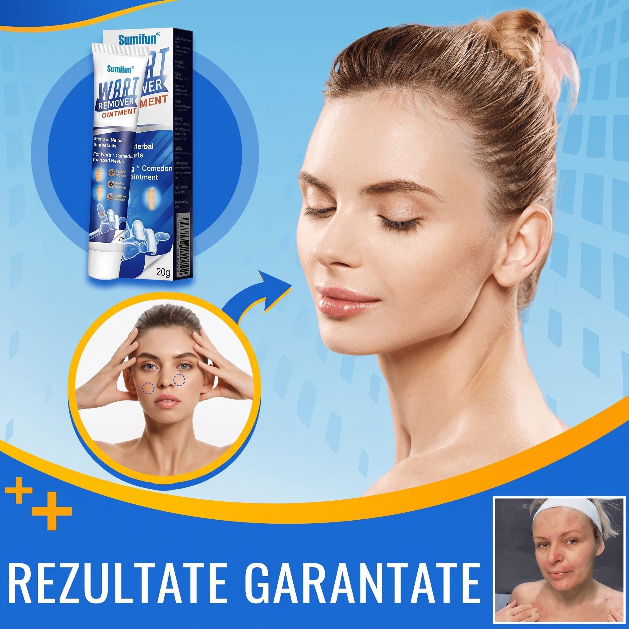 NegPro - Crema Anti Negi