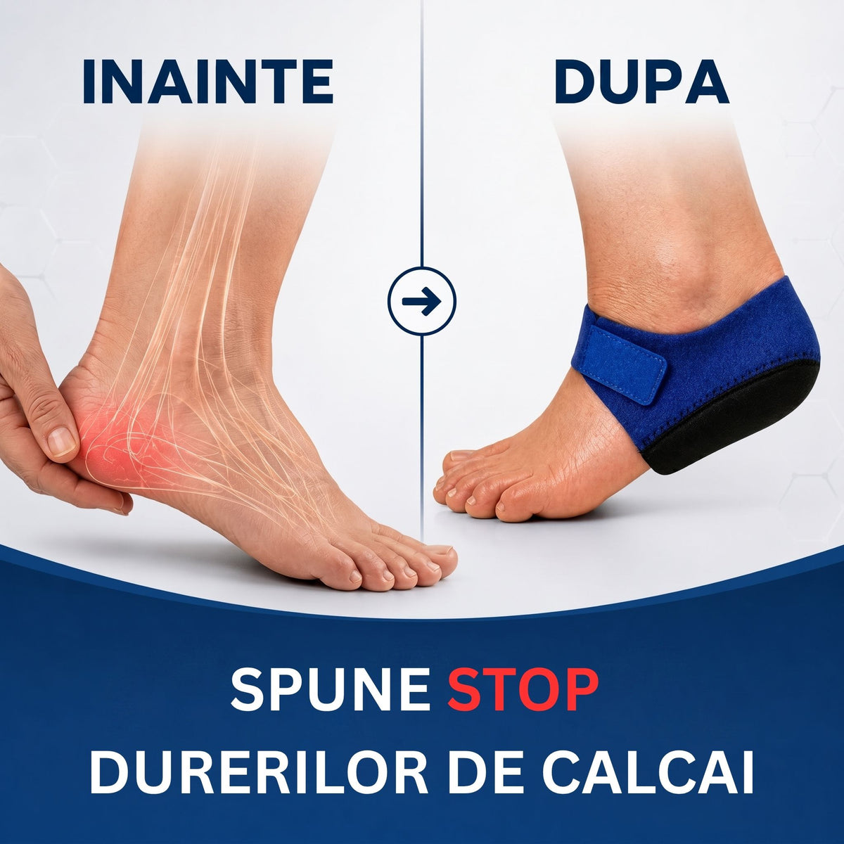 PintenFix - Remediu Pinten Calcanean